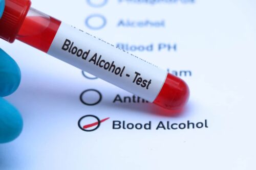 What to Know About Retrograde Extrapolation in DUI Cases.